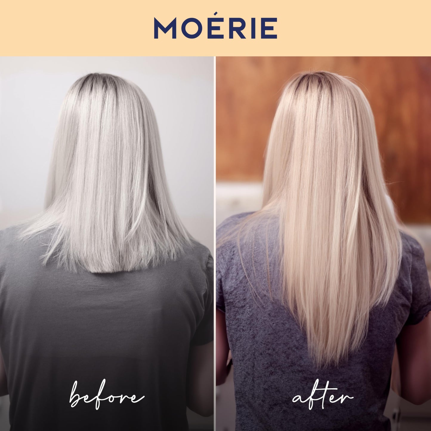 Moerie Shampoo and Conditioner Plus Hair Mask and Spray Mega Pack – The Ultimate Growth Care – For Longer, Thicker, Fuller Hair - Volumizing Products – Paraben & Silicone Free (Set of 4)